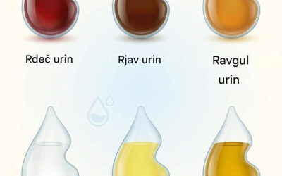 Kaj barva vašega urina pove o vašem zdravju?