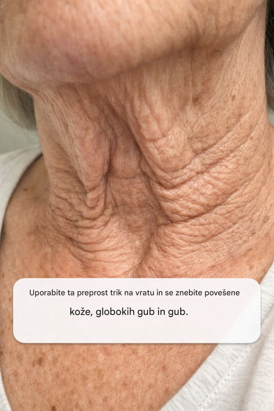 Uporabite ta preprost trik na vratu in se znebite povešene kože, globokih gub in gub.