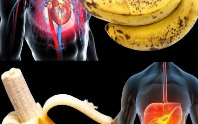 Kaj zdravniki pravijo o uživanju banan in njihovih učinkih na telo
