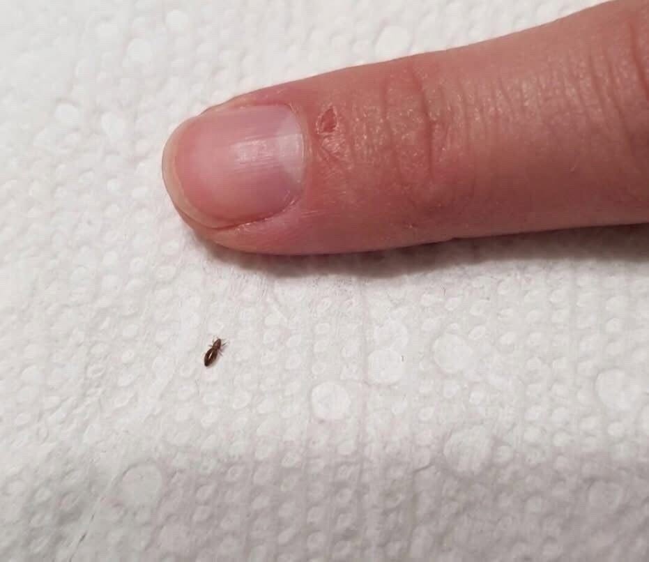"Žena je to našla v laseh našega malčka. Ali bi nas moralo kaj skrbeti? Trikrat na teden hodi v vrtec."