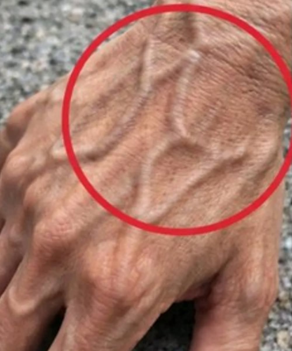 Če imate vidne žile, to pomeni, da ste ...
