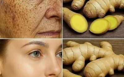 Ingver je 100-krat učinkovitejši od botoksa pri odstranjevanju globokih gub, peg in razbarvanja. Moram nekaj povedati, da boste lahko še naprej prejemali moje recepte ... Hvala! 😍 Recept v (komentar)