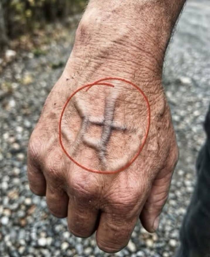 Če so vam vidne žile, to pomeni, da ste ... Več o tem