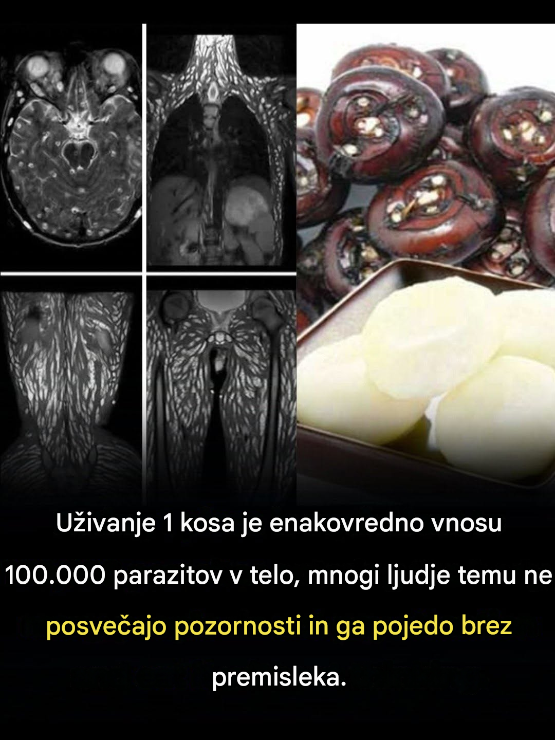 Že en grižljaj je škodljiv, a mnogi ga še vedno pojedo brez skrbi.