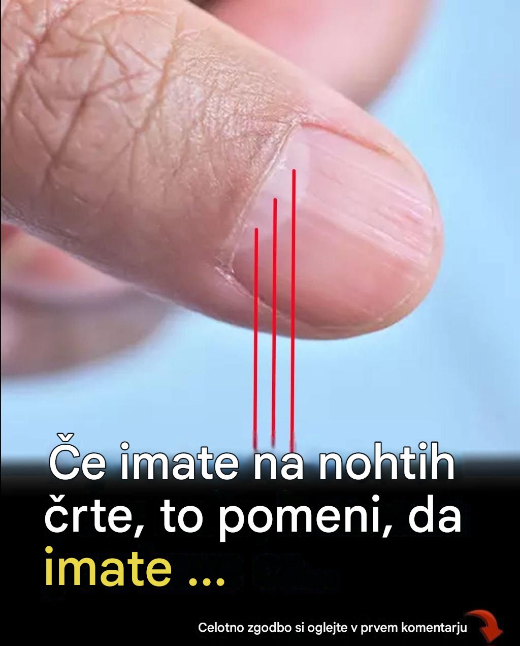 Zdravnik odkriva znak na vaših nohtih, ki lahko napoveduje vašo življenjsko dobo