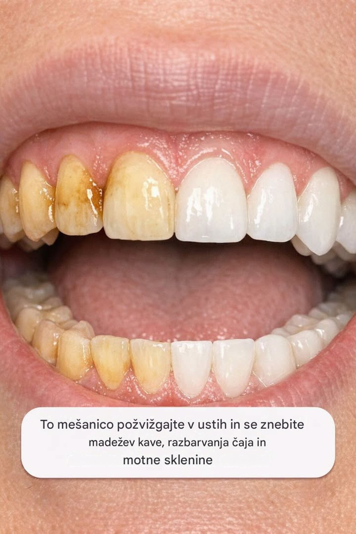 To mešanico požvižgajte v ustih in se znebite madežev kave, razbarvanja čaja in motne sklenine