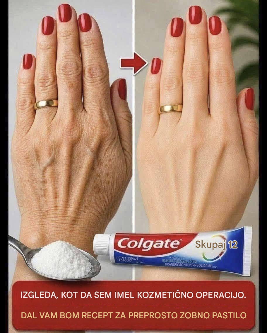 Poglej to ... Te roke so bile videti stare, polne madežev ... Več si preberi v prvem komentarju.