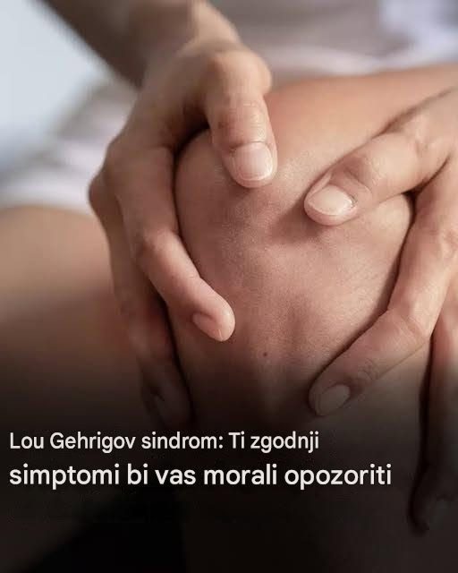Lou Gehrigov sindrom: Tukaj so prvi simptomi te bolezni