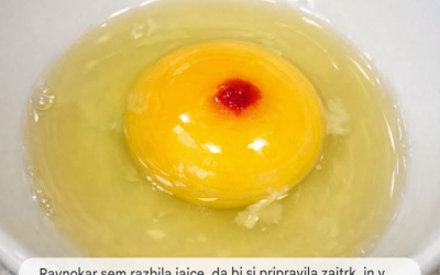Ravnokar sem razbila jajce, da bi si pripravila zajtrk, in na rumenjaku zagledala rdečo liso. Res se mi je zgrozilo in zdaj se sprašujem, ali naj vržem celo škatlo ali naj jo samo izdolbem in skuham. Kaj?